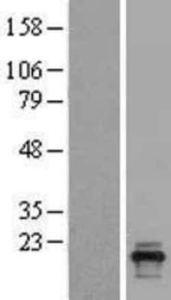 Novus Biologicals™ PLAC1L Overexpression Lysate