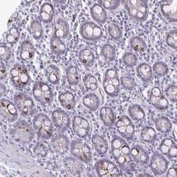PLAC1L Antibody, Novus Biologicals 25 &mu;L, Unlabeled:Antibodies, Polyclonal