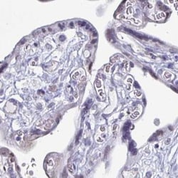 PLAC1L Antibody, Novus Biologicals 25 &mu;L, Unlabeled:Antibodies, Polyclonal