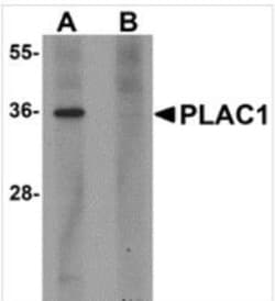 Novus Biologicals&trade;&nbsp;PLAC1 Antibody Blocking Peptide