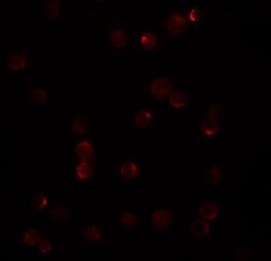 PLAC2 Antibody - BSA Free, Novus Biologicals 0.1mg; Unlabeled:Antibodies,
