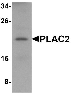 PLAC2 Antibody - BSA Free, Novus Biologicals 0.1mg; Unlabeled:Antibodies,