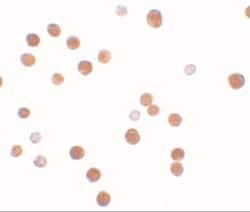 PLAC4 Antibody - BSA Free, Novus Biologicals:Antibodies:Primary Antibodies