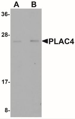 PLAC4 Antibody - BSA Free, Novus Biologicals:Antibodies:Primary Antibodies