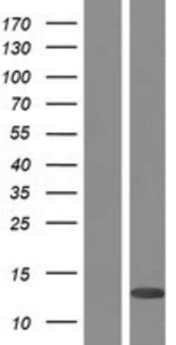 Novus Biologicals&trade;&nbsp;PLAC8 Overexpression Lysate