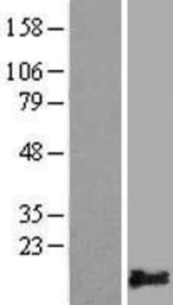 Novus Biologicals™ PLAC9 Overexpression Lysate