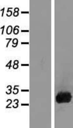 Novus Biologicals&trade;&nbsp;Placental Lactogen/CSH1 Overexpression Lysate