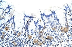 Placental Lactogen/CSH1 Antibody, Novus Biologicals 0.1mg; Unlabeled:Antibodies,