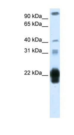 Placental Lactogen/CSH1 Antibody, Novus Biologicals 0.1mg; Unlabeled:Antibodies,