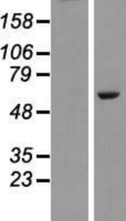 Novus Biologicals&trade;&nbsp;PLAG1 Overexpression Lysate