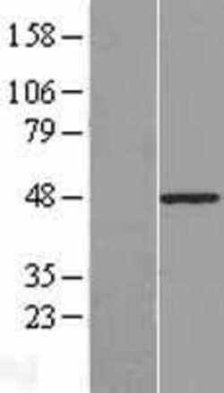 Novus Biologicals&trade;&nbsp;PLAGL1 Overexpression Lysate