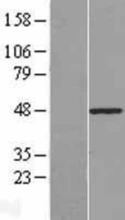 Novus Biologicals&trade;&nbsp;PLAGL1 Overexpression Lysate
