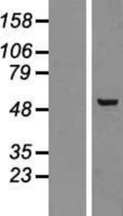 Novus Biologicals™ PLAGL2 Overexpression Lysate
