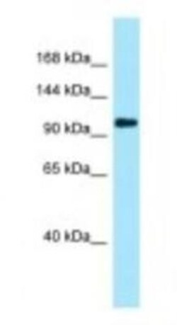 Plakophilin 4 Antibody, Novus Biologicals:Antibodies:Primary Antibodies