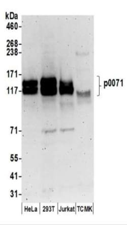 Plakophilin 4 Antibody, Novus Biologicals 100 &mu;L | Buy Online | Novus Biologicals | Fisher Scientific