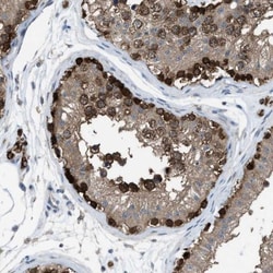 PLAP Antibody, Novus Biologicals:Antibodies:Primary Antibodies