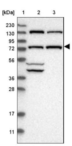 PLAP Antibody, Novus Biologicals:Antibodies:Primary Antibodies