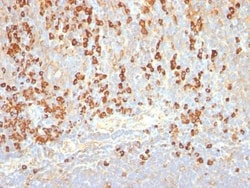 Plasma Cell Antibody (LIV3G11 (7B18)), Novus Biologicals:Antibodies:Primary
