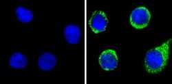 Plasminogen Antibody, Novus Biologicals 100 ug; Unconjugated:Antibodies,