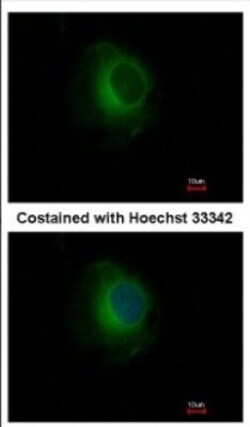 Plasminogen Antibody, Novus Biologicals 0.1mL; Unlabeled:Anticuerpos