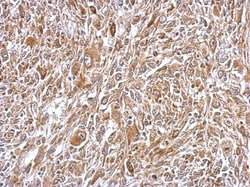 Plasminogen Antibody, Novus Biologicals 0.1mL; Unlabeled:Anticuerpos