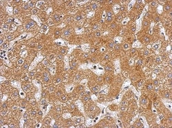 Plasminogen Antibody, Novus Biologicals 0.1mL; Unlabeled:Anticuerpos