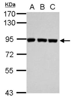 Plasminogen Antibody, Novus Biologicals 0.1mL; Unlabeled:Anticuerpos