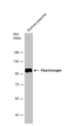 Plasminogen Antibody, Novus Biologicals 0.1mL; Unlabeled:Anticuerpos