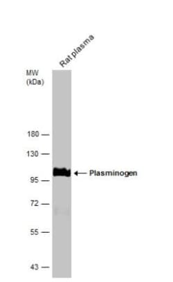 Plasminogen Antibody, Novus Biologicals 0.1mL; Unlabeled:Anticuerpos