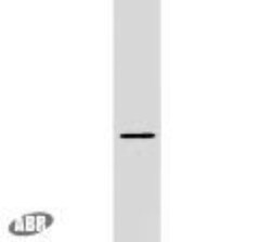 Plasmolipin Antibody, Novus Biologicals 0.1mg; Unlabeled:Antibodies, Polyclonal