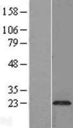 Novus Biologicals&trade;&nbsp;Plasmolipin Overexpression Lysate