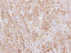Plastin L Antibody, Novus Biologicals 0.1mL; Unlabeled:Antibodies, Polyclonal