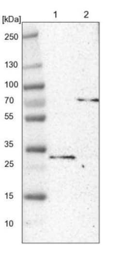 Plastin L Antibody, Novus Biologicals 0.1mL; Unlabeled:Antibodies, Polyclonal