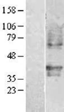 Novus Biologicals&trade;&nbsp;PAFR Overexpression Lysate