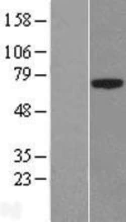 Novus Biologicals&trade;&nbsp;PLBD1 Overexpression Lysate