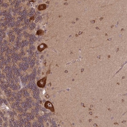 PLC-gamma 1 Antibody, Novus Biologicals 0.1mL; Unlabeled:Antibodies, Polyclonal
