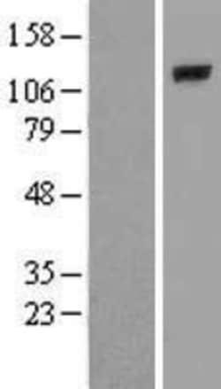 Novus Biologicals™ PLCL2 Overexpression Lysate