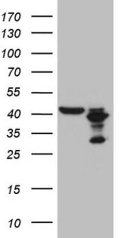 PLCXD1 Antibody (OTI2D7), Novus Biologicals 0.1 mL | Buy Online | Novus Biologicals | Fisher Scientific