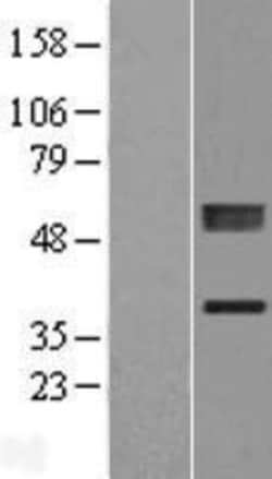 Novus Biologicals™ PLCXD1 Overexpression Lysate