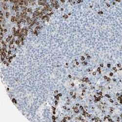 PLCXD1 Antibody, Novus Biologicals 0.1mL; Unlabeled:Antibodies, Polyclonal