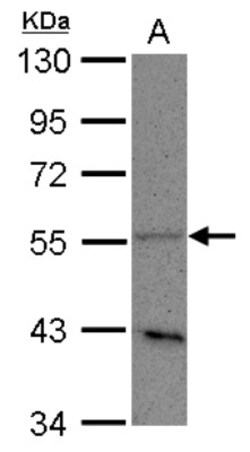 PLD3/Phospholipase D3 Antibody, Novus Biologicals 0.1mL; Unlabeled:Antibodies,