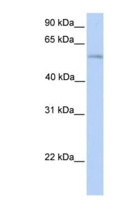 PLD3/Phospholipase D3 Antibody, Novus Biologicals 100 &mu;L | Buy Online | Novus Biologicals | Fisher Scientific