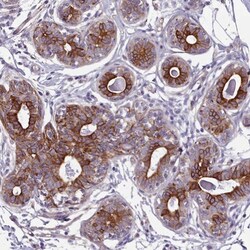PLD4/Phospholipase D4 Antibody, Novus Biologicals:Antibodies:Primary Antibodies