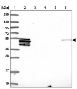 PLD4/Phospholipase D4 Antibody, Novus Biologicals:Antibodies:Primary Antibodies