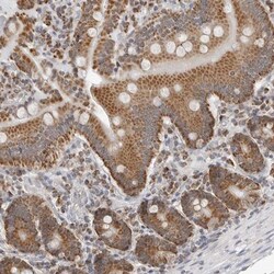 PLD5 Antibody, Novus Biologicals 25 &mu;L; Unlabeled:Antibodies, Polyclonal