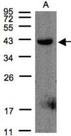 Pleckstrin Antibody, Novus Biologicals 0.1mL; Unlabeled:Antibodies, Polyclonal