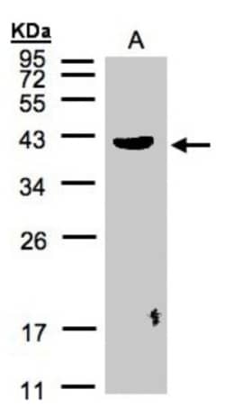 Pleckstrin Antibody, Novus Biologicals 0.1mL; Unlabeled:Antibodies, Polyclonal