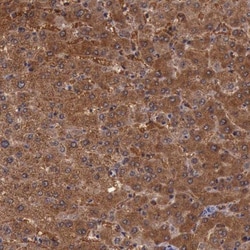 Pleckstrin-2 Antibody, Novus Biologicals 0.1mL; Unlabeled:Antibodies, Polyclonal
