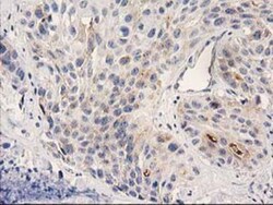 PLEKHA3 Antibody (OTI5D11), Novus Biologicals 0.1mL; Unlabeled:Antibodies,