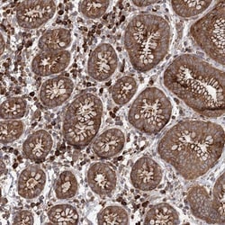 PLEKHA7 Antibody, Novus Biologicals:Antibodies:Primary Antibodies